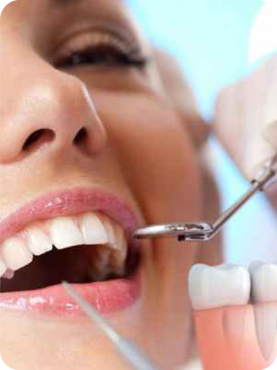 implantes dentales